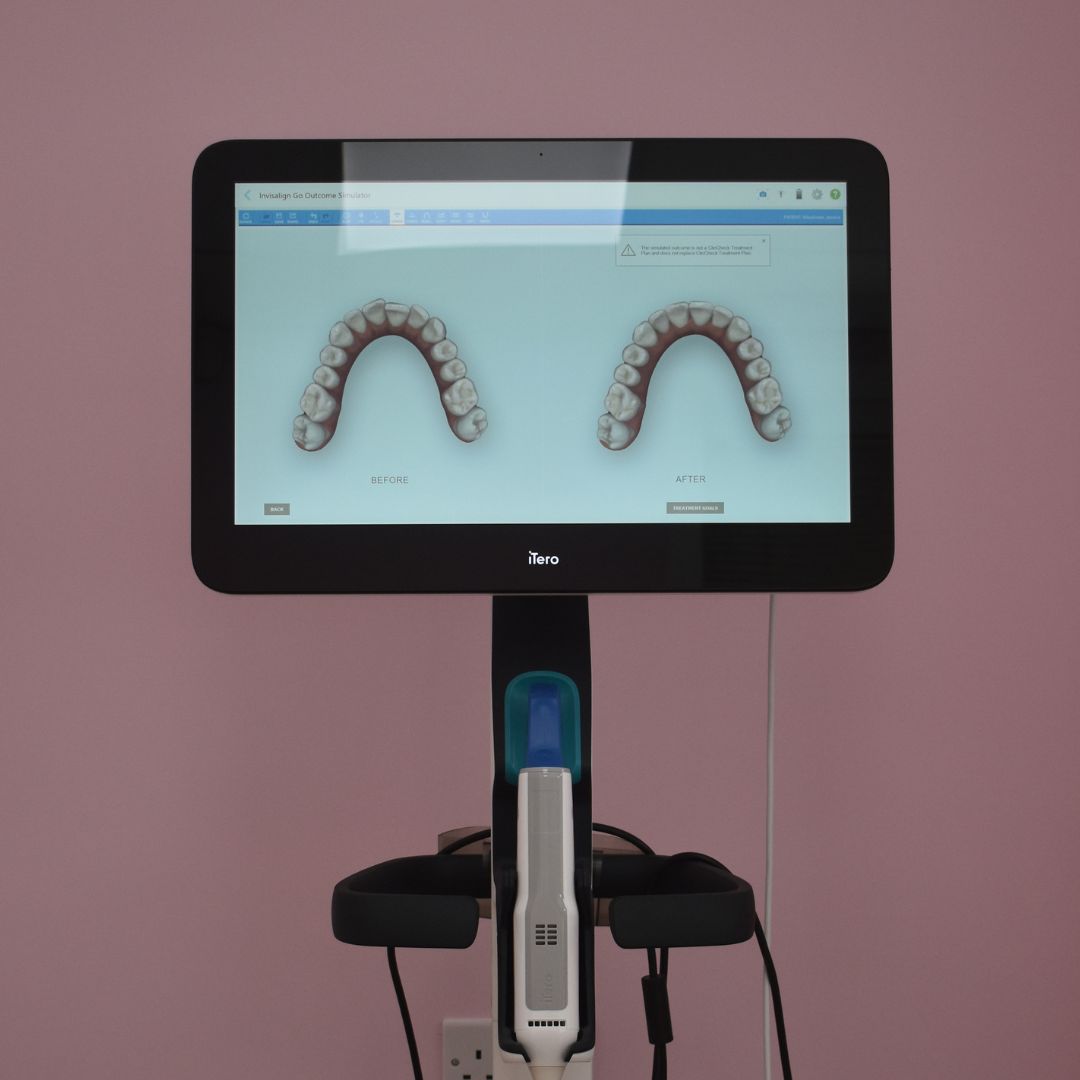 Ravenhill Dental Care Invisalign Raven Hill Practice pictures